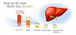fibroscan