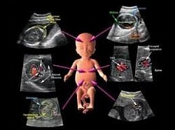 obstetric usg