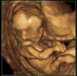 3d image
